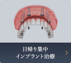 日帰り集中 インプラント治療 