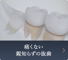 痛くない 親知らずの抜歯