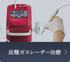炭酸ガスレーザー治療 