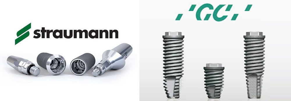 高品質なインプラントを標準採用