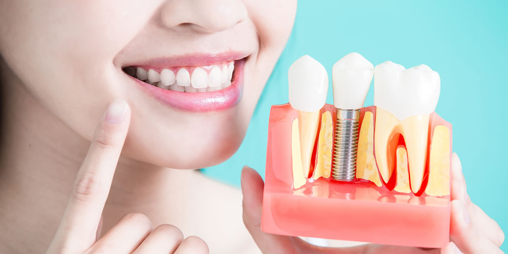 インプラント治療の成功に欠かせない2つの柱