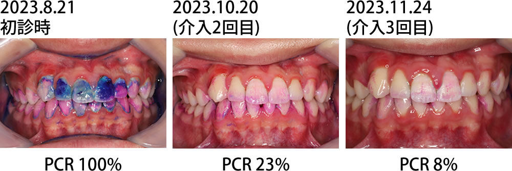 初診時からの変化