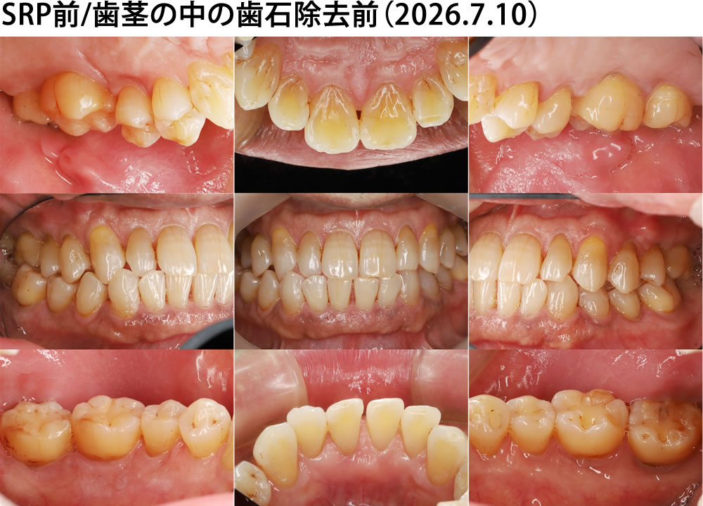 約1ヵ月後の経過観察時