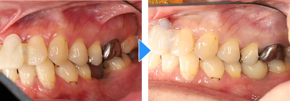 治療前後の比較