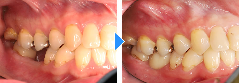 治療前後の比較