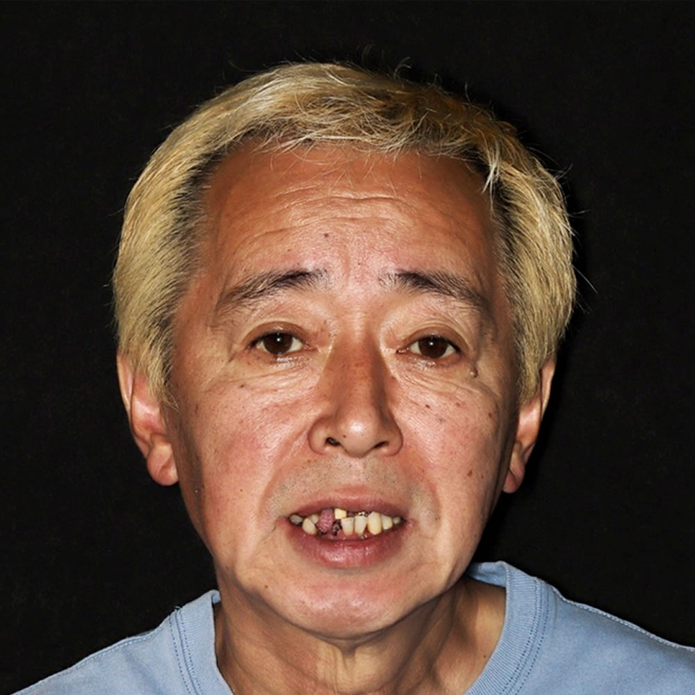 治療前