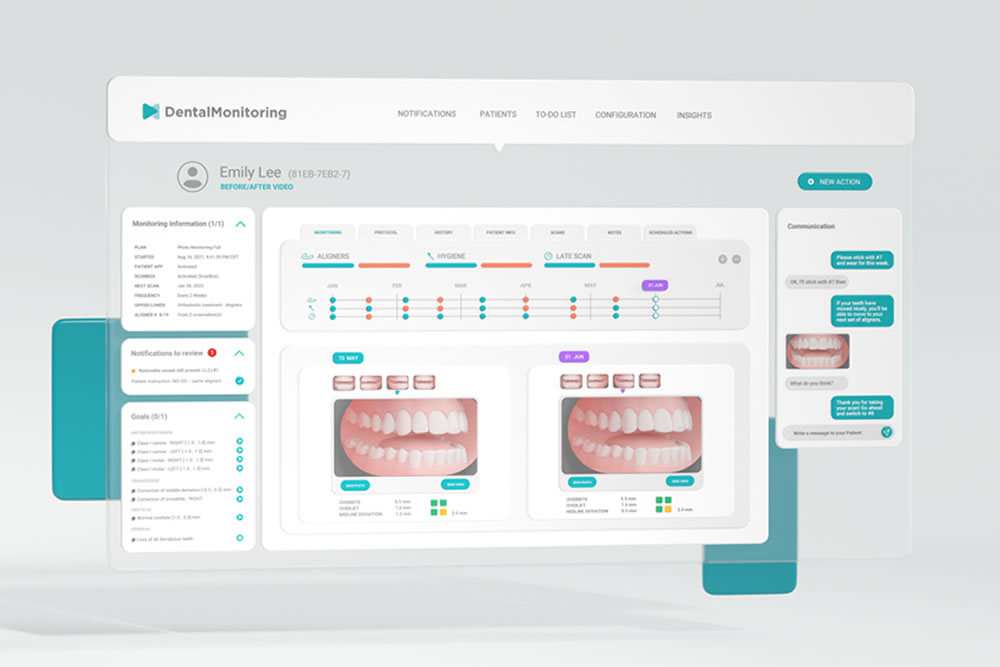 マウスピース矯正専門ドクターによる適切な口元のデザイン