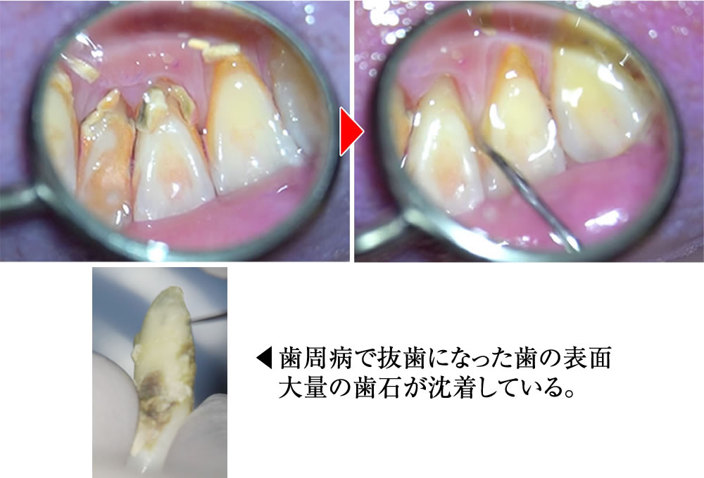対策