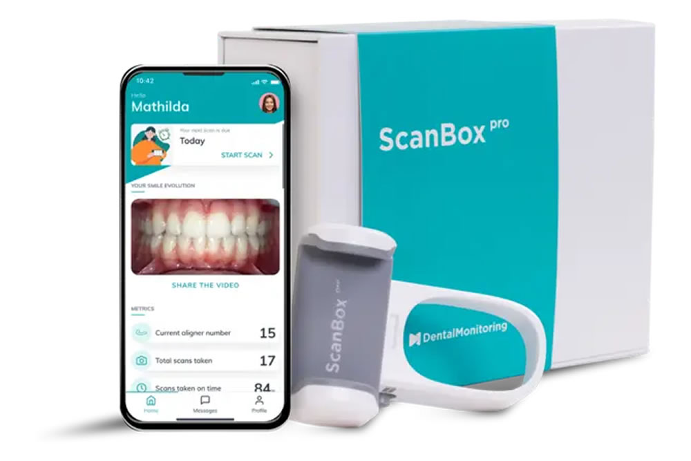 デンタルモニタリング